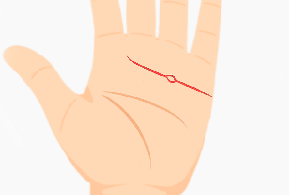 Palm with circular mark on heart line representing sadness or depression