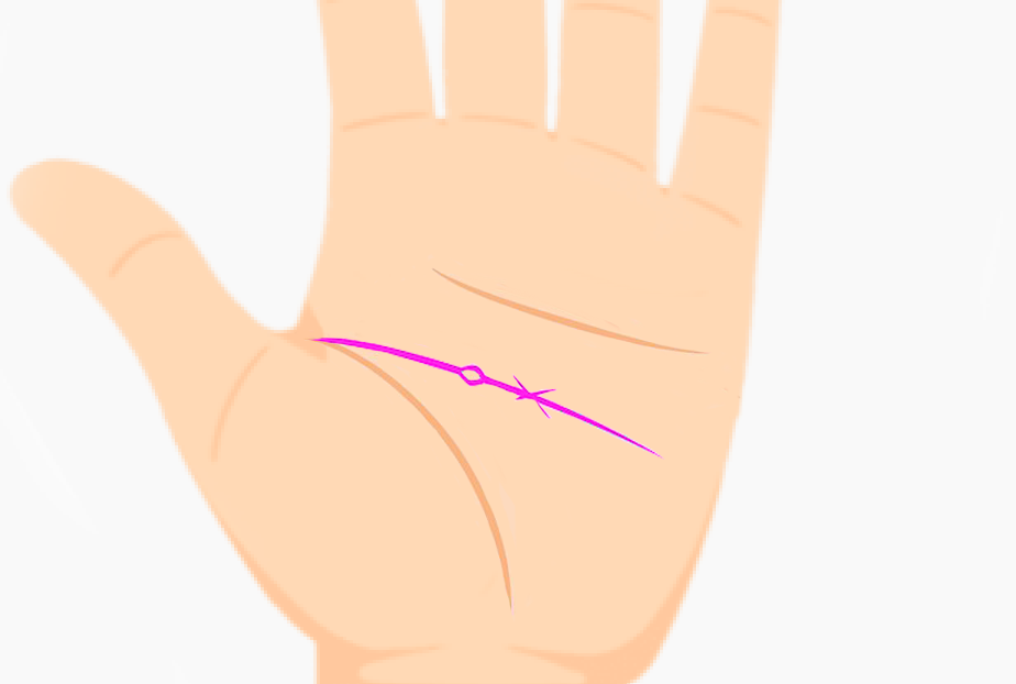 Palm showing crosses or donut shapes on head line symbolizing emotional crisis