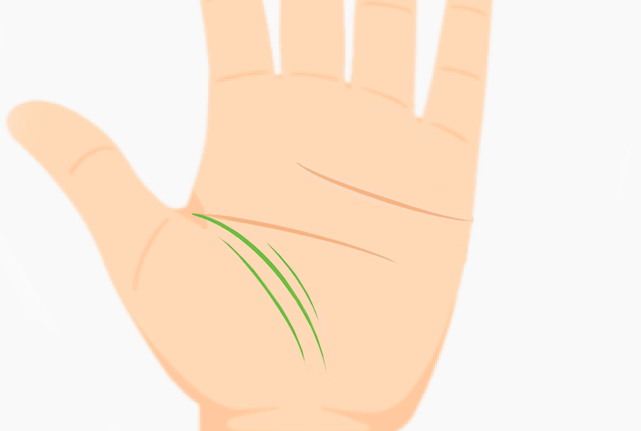 Palm showing multiple life lines suggesting extra energy and vitality