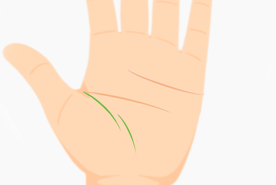 Palm with broken life line signifying sudden lifestyle changes or disruptions